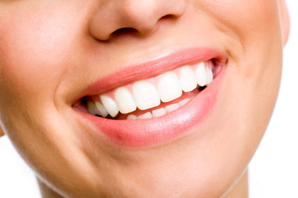 Estetica dentale