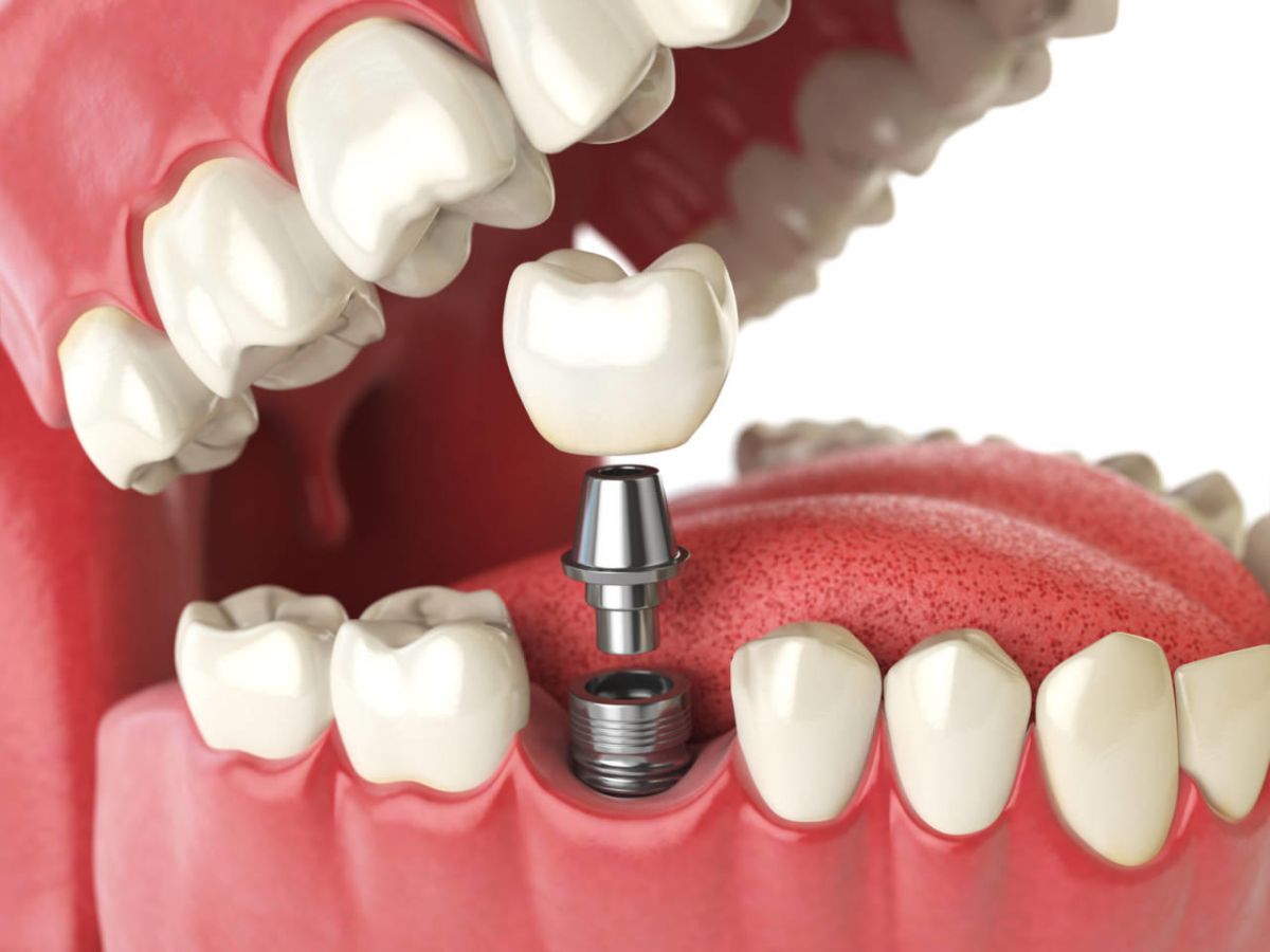 Studio dentistico Pescara